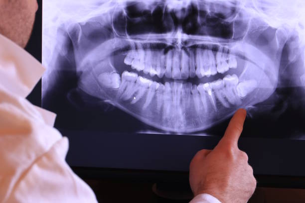 Best Dentist for Tooth Abscess  in Northchase, NC