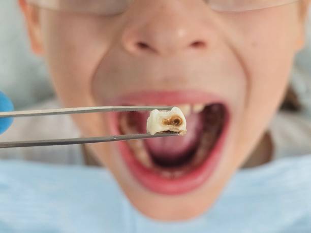 Best Urgent Tooth Repair  in Northchase, NC